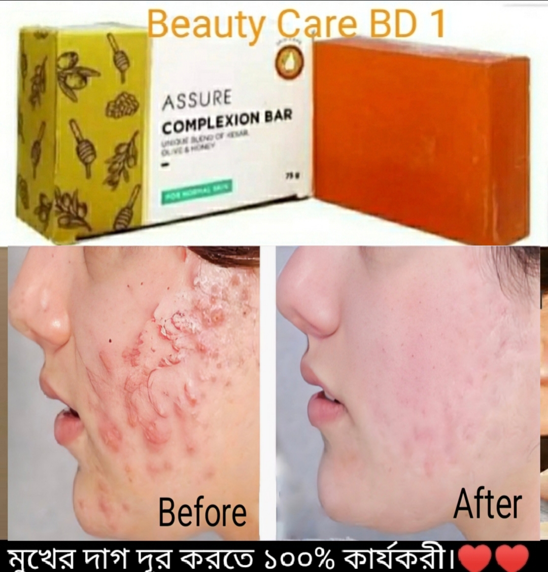 Assure Complexion Bar Soap  Indian  Honey,Olive & Jafran Enriched. 
