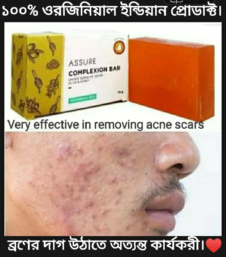 Assure Complexion Bar Soap  Indian  Honey,Olive & Jafran Enriched. 