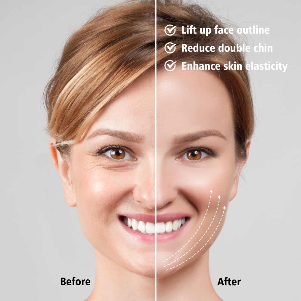 Face Lifting Machine Electric V-Face Shaping Massager Vibration Slimming Double Chin Reducer V-Line Cheek Lift Up Face Slimming. 