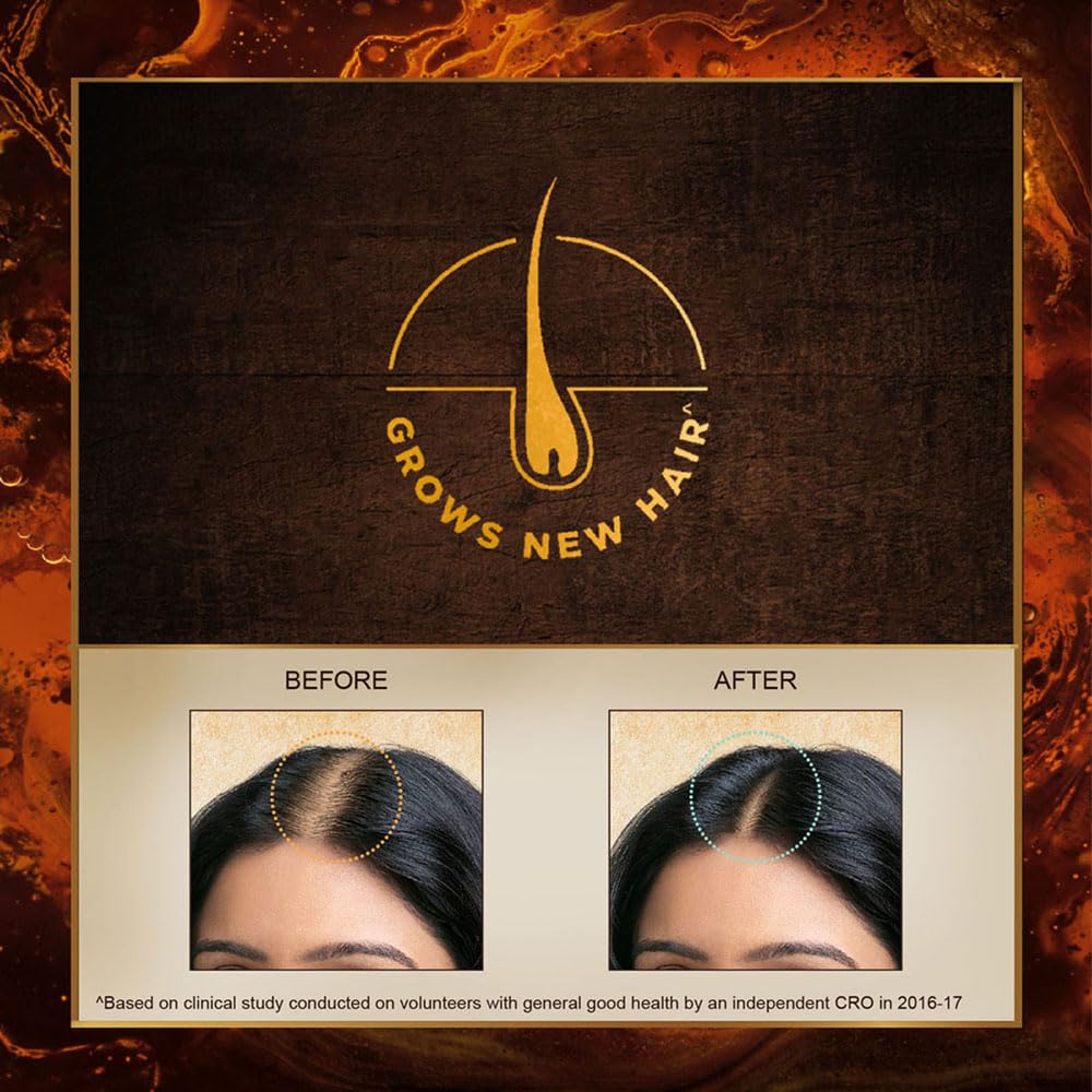 Indulekha Bringha Hair Oil 100 ML | Anti Hair Fall |  Hair Growth Oil |. 